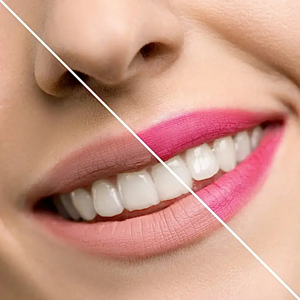 Inuwet Limon Kokulu Dudak Koruyucu Lip Stick